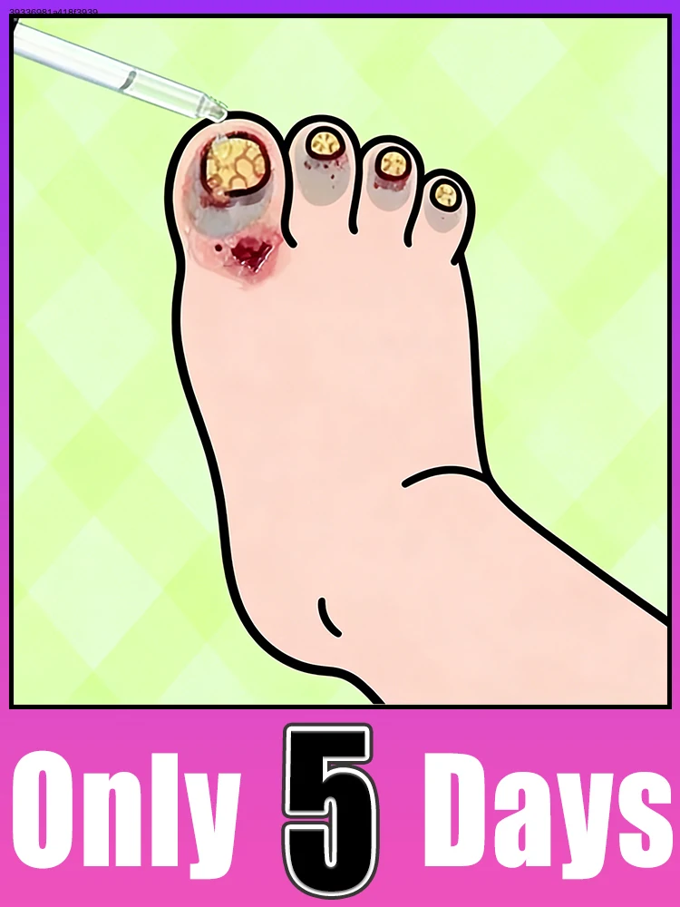 Bʀᴇᴀᴋ ғʀᴇᴇ ғʀᴏᴍ ᴅʀʏ ᴄʀᴀᴄᴋᴇᴅ ᴄᴜᴛɪᴄʟᴇs, ᴋᴇᴇᴘ ғɪɴɢᴇʀᴛɪᴘs sᴏғᴛ ᴀɴᴅ ɴᴏᴜʀɪsʜᴇᴅ
Bʀᴇᴀᴋ ғʀᴇᴇ ғʀᴏᴍ ᴅʀʏ ᴄʀᴀᴄᴋᴇᴅ ᴄᴜᴛɪᴄʟᴇs, ᴋᴇᴇᴘ ғɪɴɢᴇʀᴛɪᴘs sᴏғᴛ ᴀɴᴅ ɴᴏᴜʀɪsʜᴇᴅ