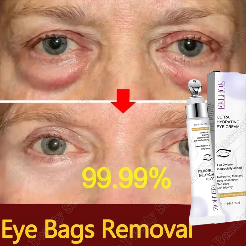 Instant Eye Bag Removal Cream Collagen Anti-Wrinkle Fade Fine Lines Firming Skin Anti Dark Circle Puffiness Brighten Eye Care
Instant Eye Bag Removal Cream Collagen Anti-Wrinkle Fade Fine Lines Firming Skin Anti Dark Circle Puffiness Brighten Eye Care
