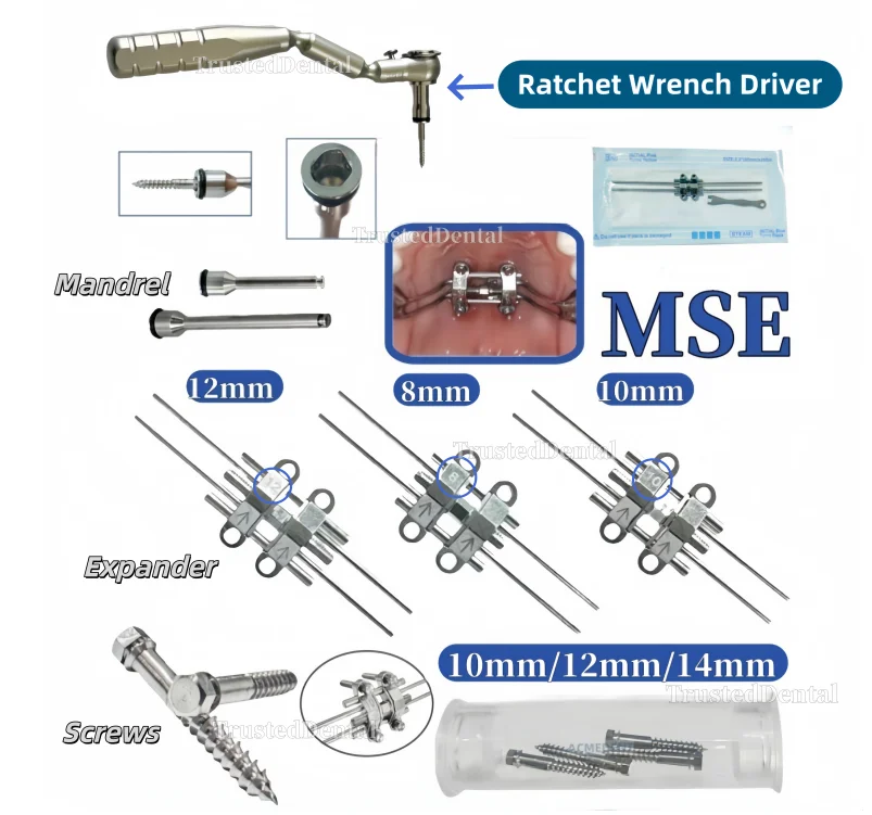 Стоматологическая ортодонтия MSE, мини-винты, верхнещелепный ракелетный расширитель, гаечный ключ, оправка, ключ с храповым механизмом двигателя, драйвер
Стоматологическая ортодонтия MSE, мини-винты, верхнещелепный ракелетный расширитель, гаечный ключ, оправка, ключ с храповым механизмом двигателя, драйвер