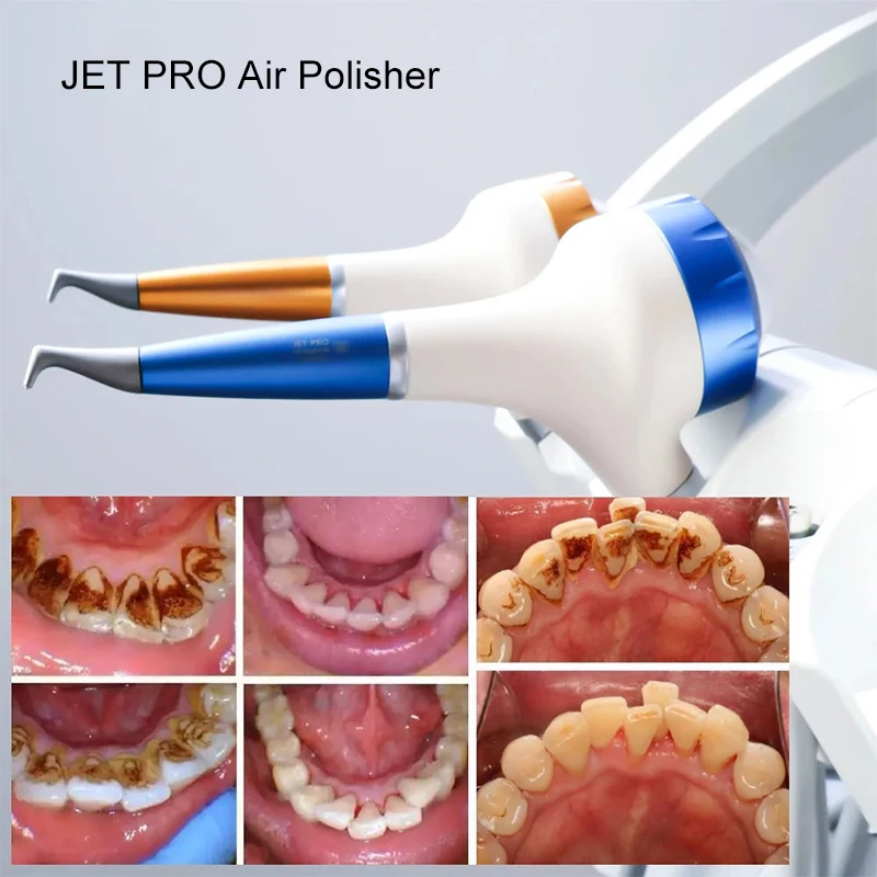VVDental Dental Air Polisher with Subgingival Function JET PRO 0.7mm Nozzle for Periodontal Care Dental Unit
VVDental Dental Air Polisher with Subgingival Function JET PRO 0.7mm Nozzle for Periodontal Care Dental Unit