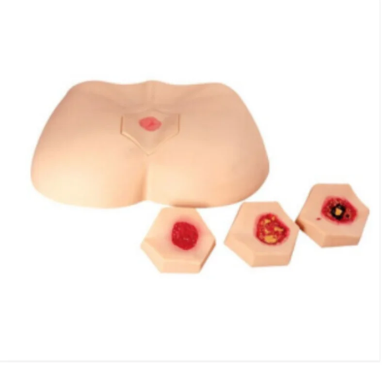 BIX-H10B Medical Training Model New Type Stage Bedsore Decubitus Ulcer Care Simulator
BIX-H10B Medical Training Model New Type Stage Bedsore Decubitus Ulcer Care Simulator