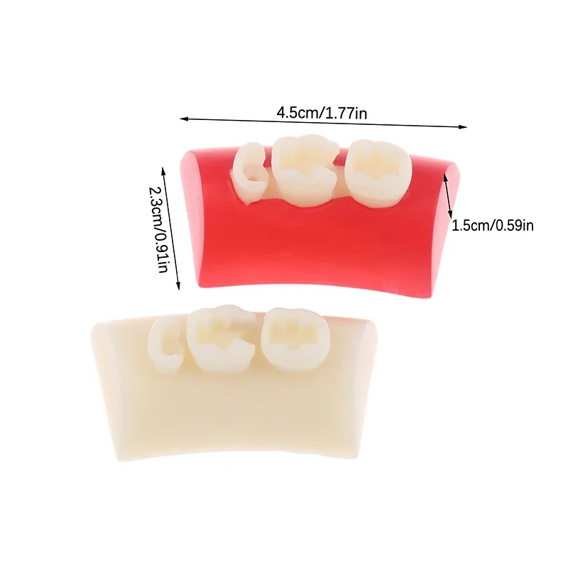 Dental Inlay Exercise Model Block Filling Exercise Typodont Resin Materials Oral Filling Model For Dentistry Teaching Stud
Dental Inlay Exercise Model Block Filling Exercise Typodont Resin Materials Oral Filling Model For Dentistry Teaching Stud