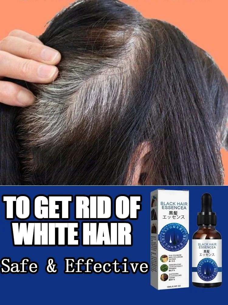 Anti-grey hair essence Serum treatment restore naturalcolor and restore healthy White To Black hair products essence 111
Anti-grey hair essence Serum treatment restore naturalcolor and restore healthy White To Black hair products essence 111