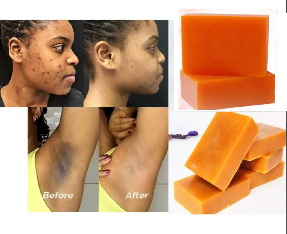 Tumeric Kojic Soap, Spots Remover, Even Skin Tone,Spotless Skin,Tumeric Soap, Acne Soap, Flawless Skin, Best Soap Ever
Tumeric Kojic Soap, Spots Remover, Even Skin Tone,Spotless Skin,Tumeric Soap, Acne Soap, Flawless Skin, Best Soap Ever