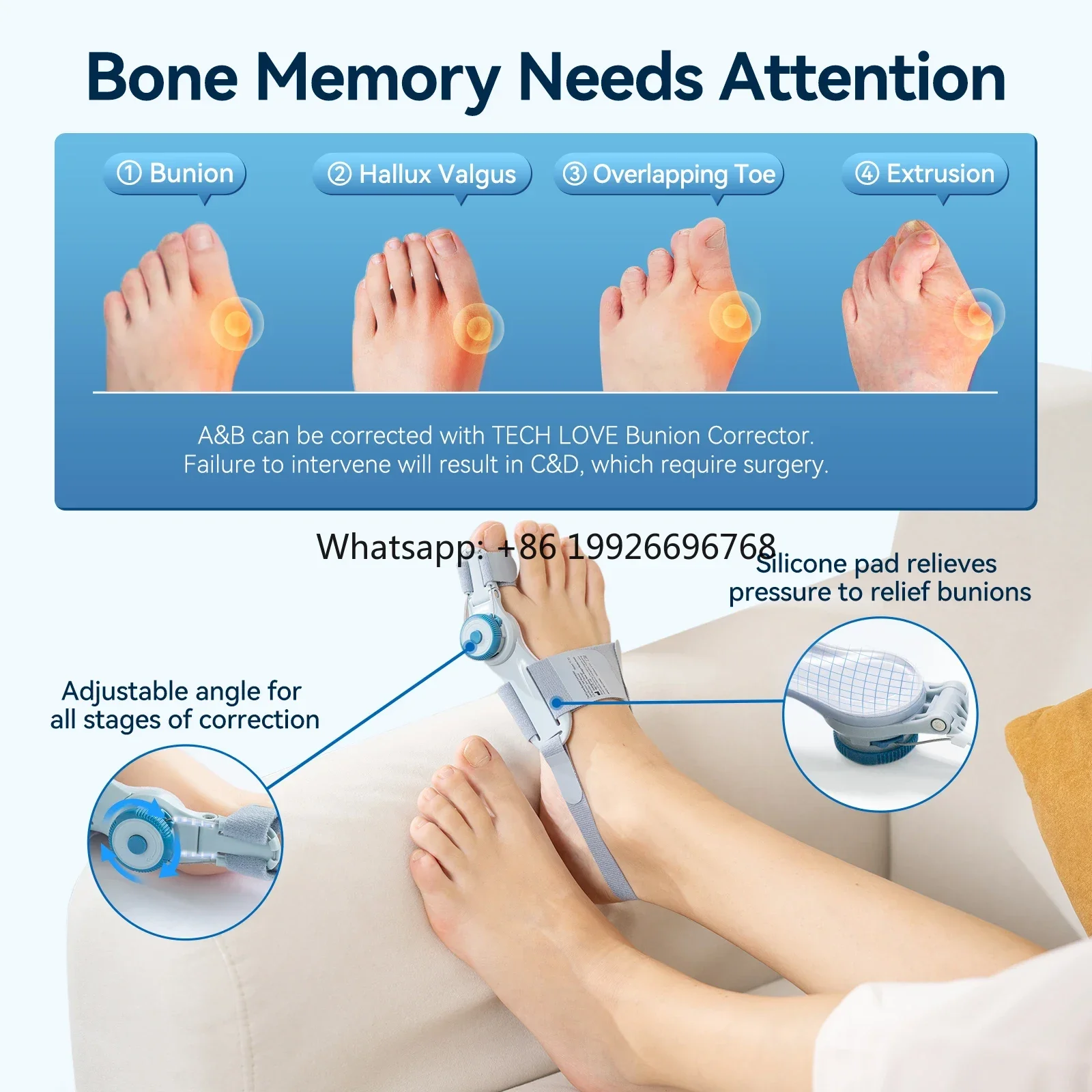 Fast ShippingBest Selling Forefoot Straightener Equipment with Big Separators Flexible Rehabilitation Alicates for Toe UseGood s
Fast ShippingBest Selling Forefoot Straightener Equipment with Big Separators Flexible Rehabilitation Alicates for Toe UseGood s