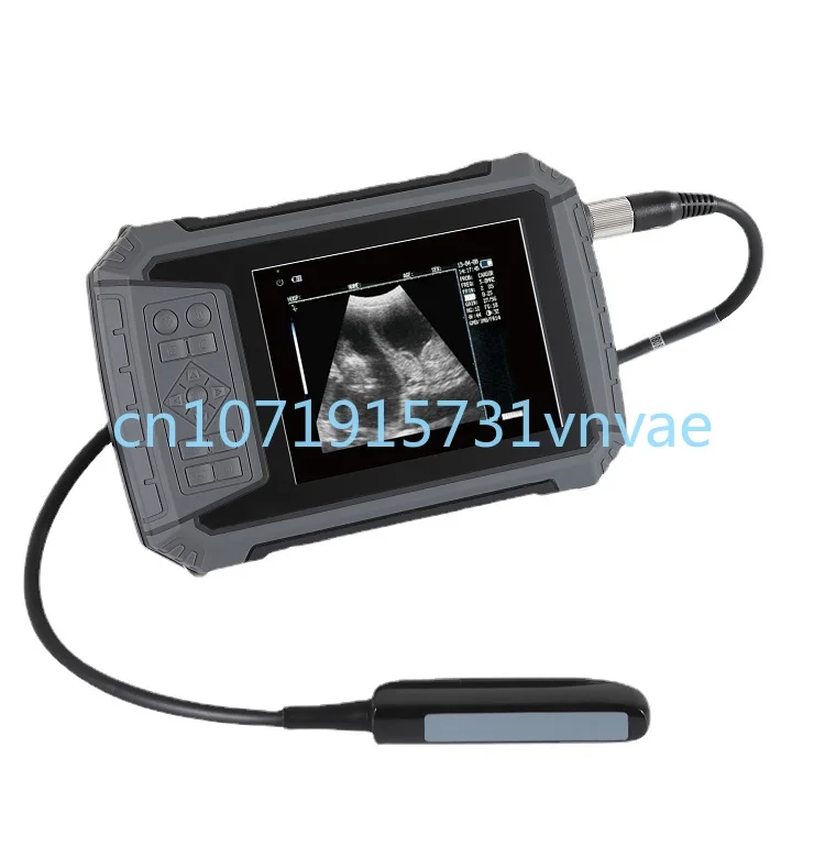 MT Medical Wholesale 5.7 Inch High Resolution Display Handheld Veterinary Ultrasound Scanner Portable Veterinary Ultrasound
MT Medical Wholesale 5.7 Inch High Resolution Display Handheld Veterinary Ultrasound Scanner Portable Veterinary Ultrasound