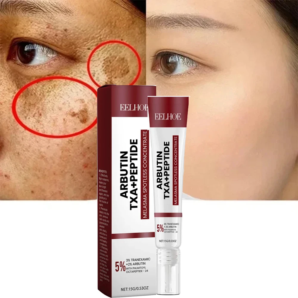 Powerful Whitening Freckle Cream Melasma Dark Spots Pigmentation Removal Products Fade Stain Melanin Repair Brighten Skin Care
Powerful Whitening Freckle Cream Melasma Dark Spots Pigmentation Removal Products Fade Stain Melanin Repair Brighten Skin Care
