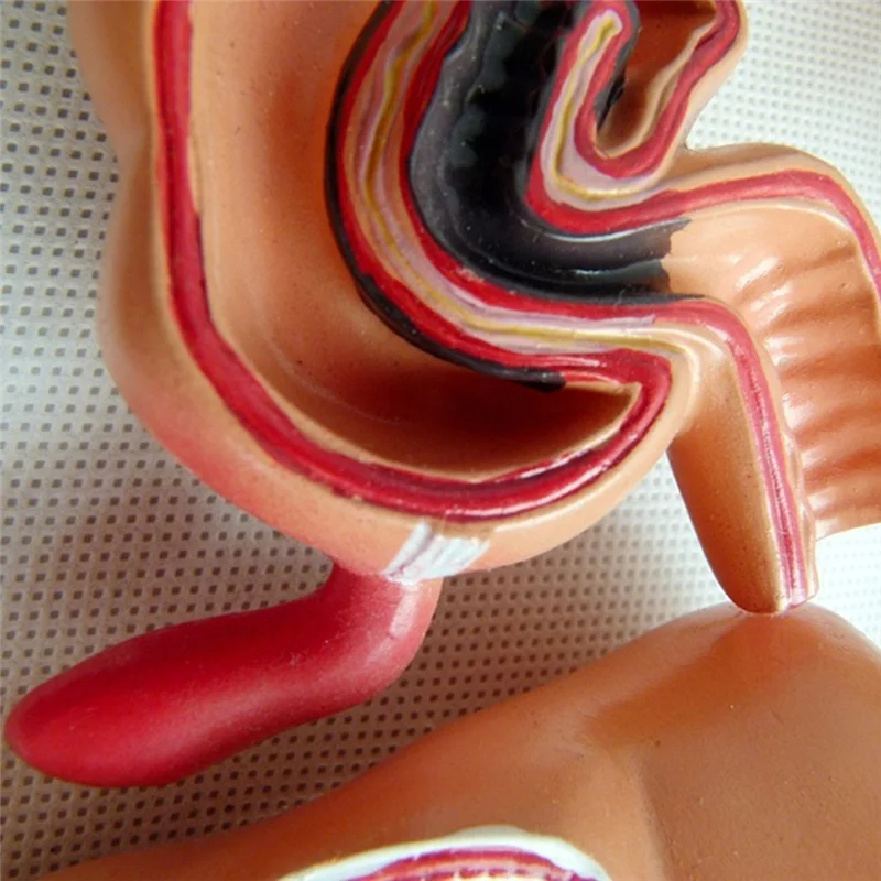 Teaching Model,Human Large Intestine Anatomy Model Visceral Lesion Model Human Digestive System Learning Model Easy Install
Teaching Model,Human Large Intestine Anatomy Model Visceral Lesion Model Human Digestive System Learning Model Easy Install