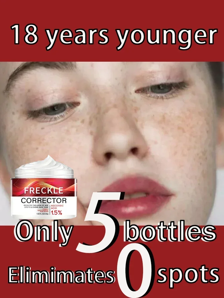 Whitening Freckle Cream Effective Remove Melasma Cream Remove Dark Spots Melanin Moisturize Brighten Smooth Face Skin Care
Whitening Freckle Cream Effective Remove Melasma Cream Remove Dark Spots Melanin Moisturize Brighten Smooth Face Skin Care