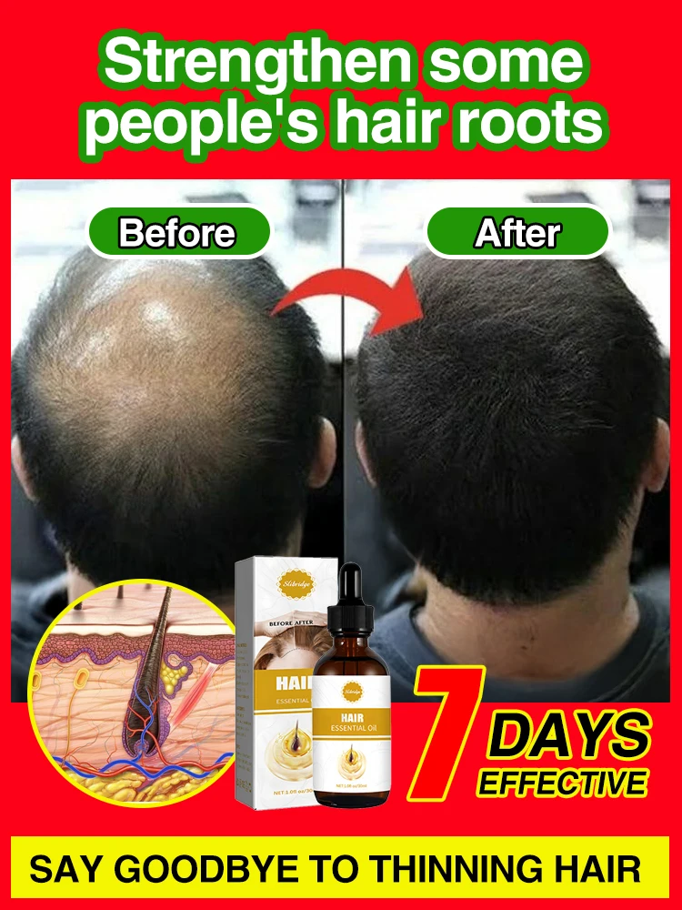 Tell Alpha about Hair Thinning, Hair Care, Repair and Prevention of Hair Thinning 
Tell Alpha about Hair Thinning, Hair Care, Repair and Prevention of Hair Thinning