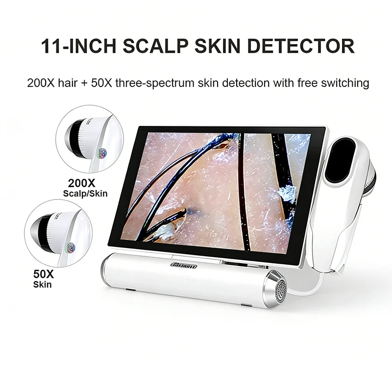 11 Inch Professional High Quality HD Hair Follicles Scalp Scanner Detector Hair Analyzer / Skin And Scalp Hair Analysis Machine
11 Inch Professional High Quality HD Hair Follicles Scalp Scanner Detector Hair Analyzer / Skin And Scalp Hair Analysis Machine