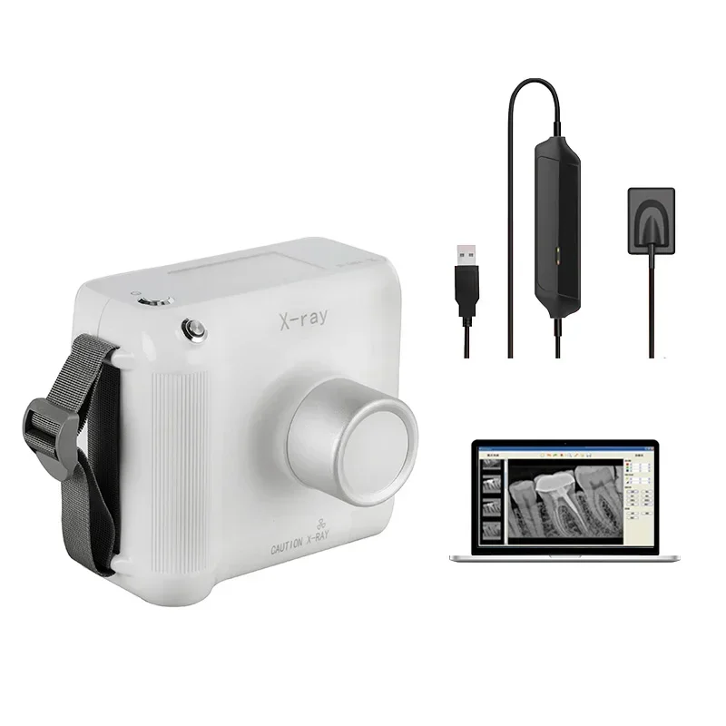 2026 Premium High Quality Good Price Equipment X Ray Machine Portable Xray Sensor Digital X-ray
2026 Premium High Quality Good Price Equipment X Ray Machine Portable Xray Sensor Digital X-ray
