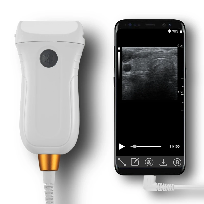 Waterproof Veterinary Type C Portable Ultrasound Convex Linear Rectal Probe for Animal
Waterproof Veterinary Type C Portable Ultrasound Convex Linear Rectal Probe for Animal