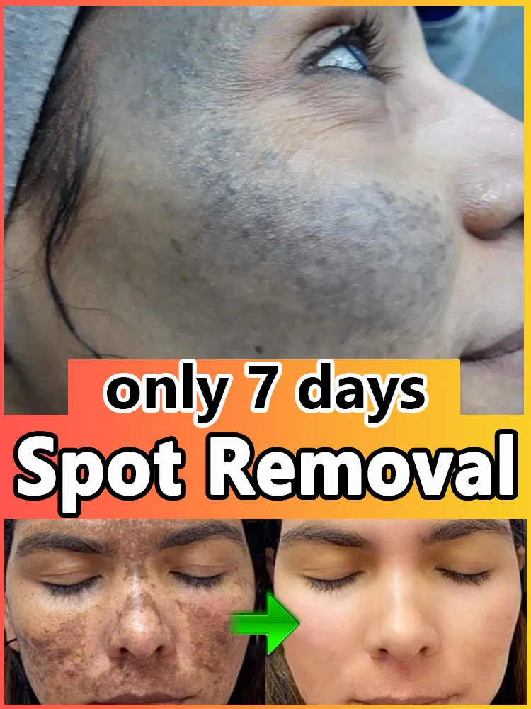 Локшина быстрого приготовления, коричневая, для лапши быстрого приготовления.
Локшина быстрого приготовления, коричневая, для лапши быстрого приготовления.