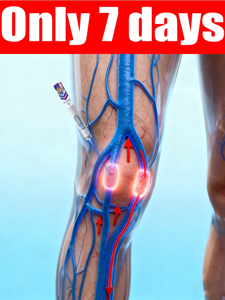 Lᴀsᴇʀ ɪɴsᴛʀᴜᴍᴇɴᴛ ғᴏʀ ᴠᴀʀɪᴄᴏsᴇ ᴠᴇɪɴ ᴄᴏʀʀᴇᴄᴛɪᴏɴ
Lᴀsᴇʀ ɪɴsᴛʀᴜᴍᴇɴᴛ ғᴏʀ ᴠᴀʀɪᴄᴏsᴇ ᴠᴇɪɴ ᴄᴏʀʀᴇᴄᴛɪᴏɴ