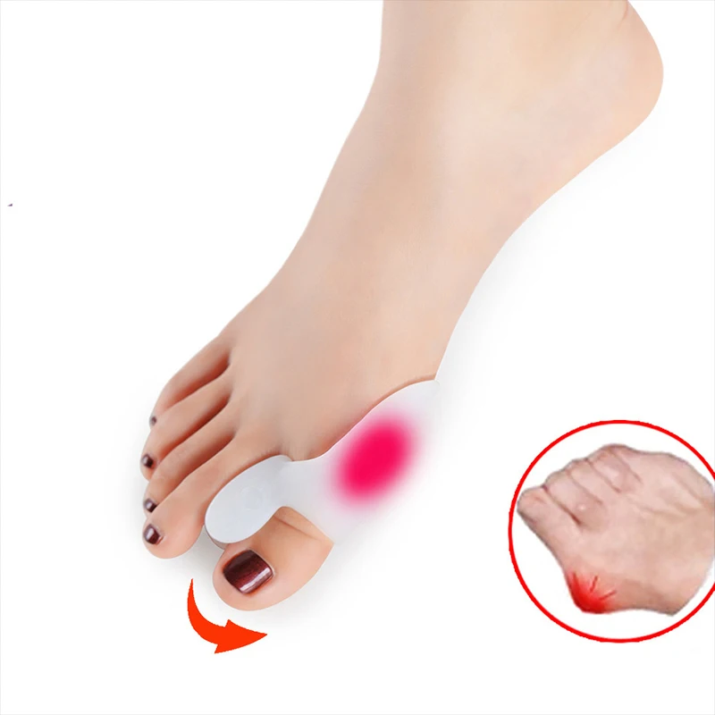 2pcs Silicone Gel Thumb Corrector Bunion Little Toe Protector Separator Hallux Valgus Finger Straightener Foot Care Relief Pads
2pcs Silicone Gel Thumb Corrector Bunion Little Toe Protector Separator Hallux Valgus Finger Straightener Foot Care Relief Pads