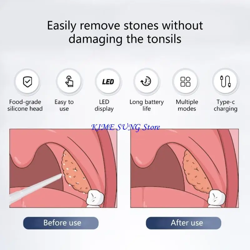 3 Adjustable Speeds Tonsil Tool Suitable for Accurate Results L5BD
3 Adjustable Speeds Tonsil Tool Suitable for Accurate Results L5BD