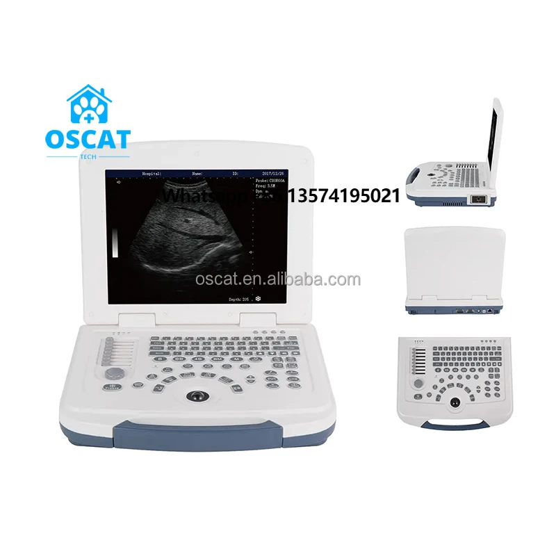 OSCAT Veterinary Equipment Laptop Portable 3D Animals Ultrasound Veterinary Ultrasound Machine
OSCAT Veterinary Equipment Laptop Portable 3D Animals Ultrasound Veterinary Ultrasound Machine