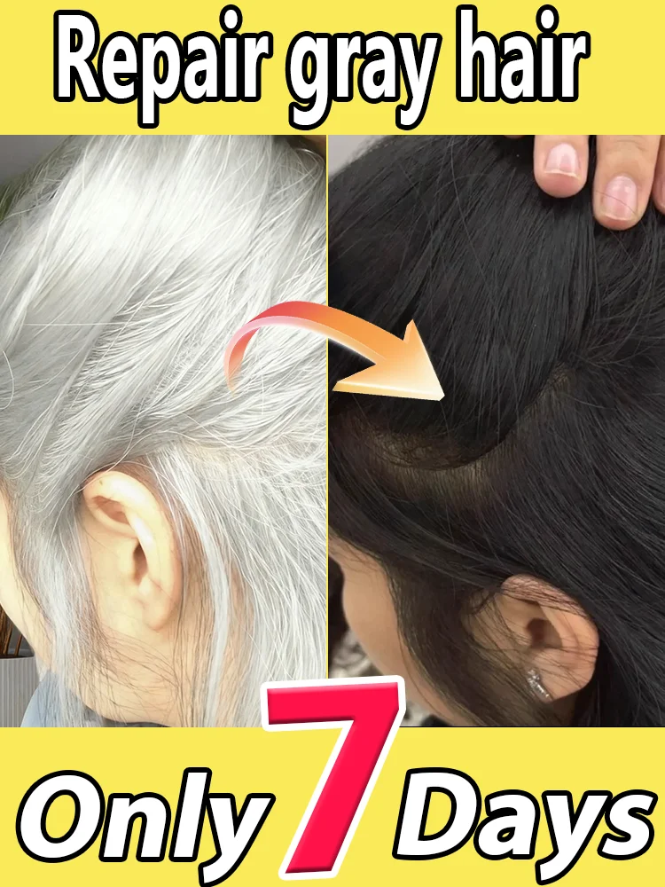 White to Black Hair Serum Gʀᴀʏ Hᴀɪʀ Tʀᴇᴀᴛᴍᴇɴᴛ Nᴀᴛᴜʀᴀʟ Cᴏʟᴏʀ Rᴇᴘᴀɪʀ Nᴏᴜʀɪsʜɪɴɢ Aɴᴛɪ-Hᴀɪʀ Lᴏss Cᴀʀᴇ Mᴇɴ Wᴏᴍᴇɴ
White to Black Hair Serum Gʀᴀʏ Hᴀɪʀ Tʀᴇᴀᴛᴍᴇɴᴛ Nᴀᴛᴜʀᴀʟ Cᴏʟᴏʀ Rᴇᴘᴀɪʀ Nᴏᴜʀɪsʜɪɴɢ Aɴᴛɪ-Hᴀɪʀ Lᴏss Cᴀʀᴇ Mᴇɴ Wᴏᴍᴇɴ