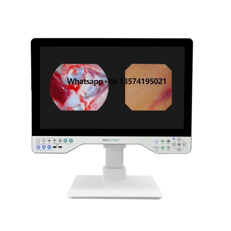 TUYOU Hot Selling FHD 24 Inch Rigid and Flexible All in One Endoscope System Usage in Laparoscopy
TUYOU Hot Selling FHD 24 Inch Rigid and Flexible All in One Endoscope System Usage in Laparoscopy