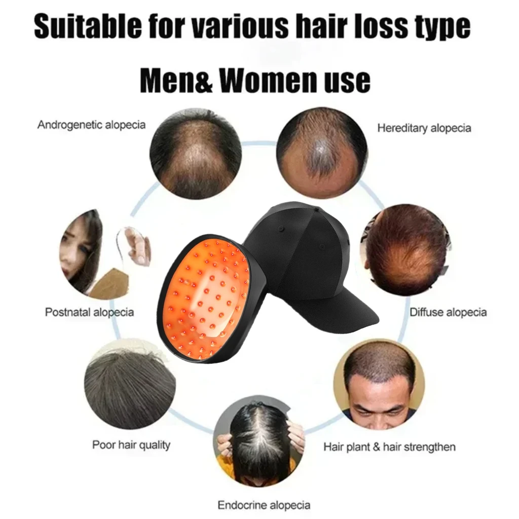 Portable Laser Hair Growth Cap Red Light Low Level Laser Devices Promote Hair Growth in Women and Men 2025
Portable Laser Hair Growth Cap Red Light Low Level Laser Devices Promote Hair Growth in Women and Men 2025