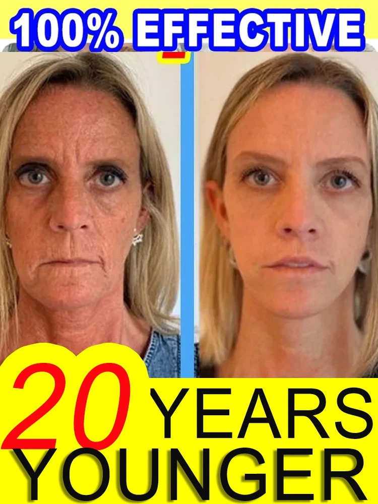 beauty anti-wrinkle oxys cream wrinkles remover bubbles skincare coreanos whitening cream Anti-wrinkle facia ankorean skin care
beauty anti-wrinkle oxys cream wrinkles remover bubbles skincare coreanos whitening cream Anti-wrinkle facia ankorean skin care