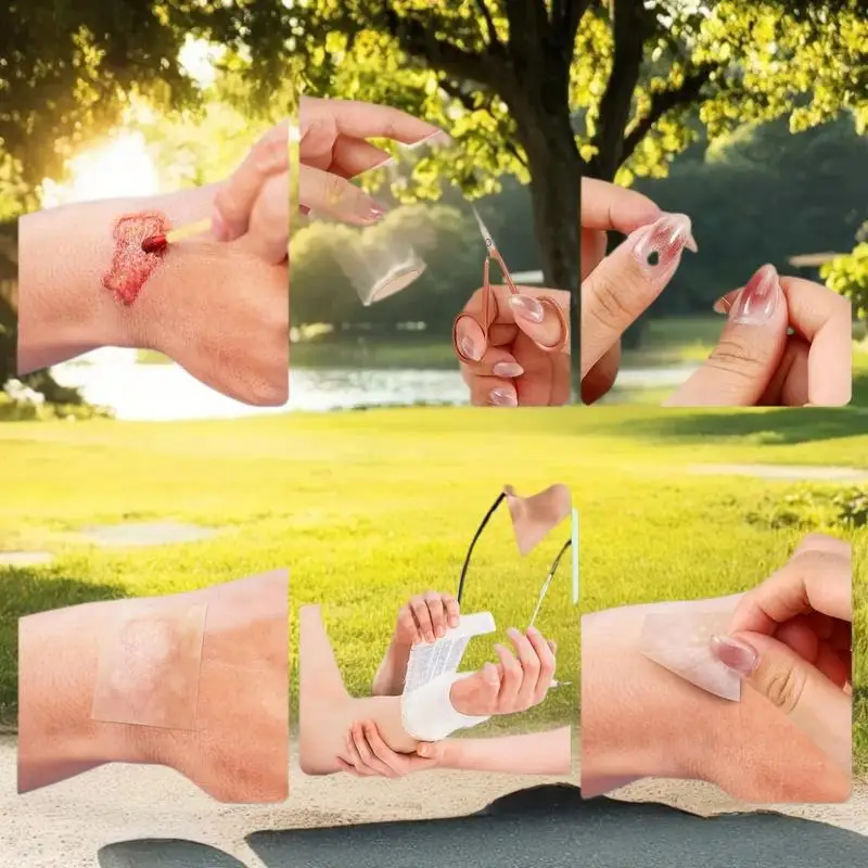 1 рулон гидроколлоидной повязки для эффективного ухода за ранами, очень тонкая, мягкая, водонепроницаемая, самоклеящаяся лента для покрытия шрамов
1 рулон гидроколлоидной повязки для эффективного ухода за ранами, очень тонкая, мягкая, водонепроницаемая, самоклеящаяся лента для покрытия шрамов