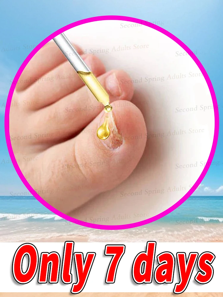 10ml Ingrown Paronychia Toenail Corrector Strips Anti Nail Patch Feet Sleeping Nail Patch Nails into the Flesh Foot Care Tool
10ml Ingrown Paronychia Toenail Corrector Strips Anti Nail Patch Feet Sleeping Nail Patch Nails into the Flesh Foot Care Tool