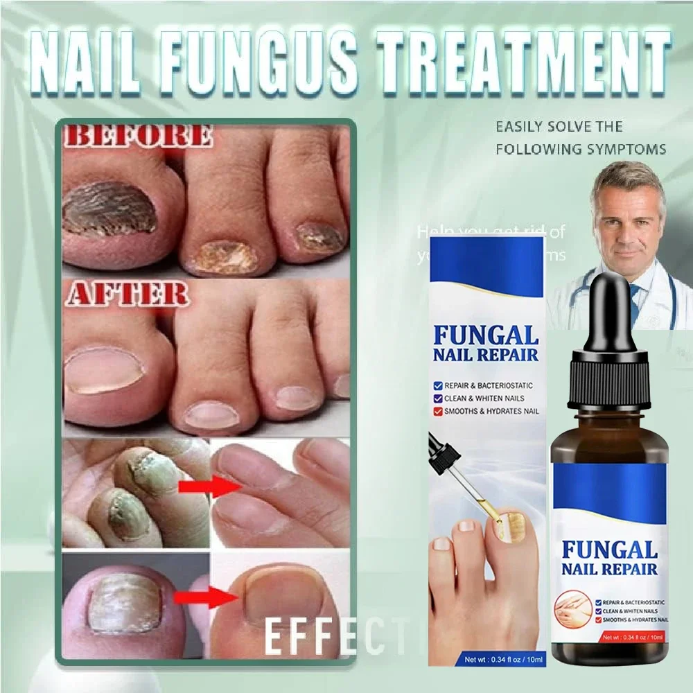 ʰᵉˡˡᵒ Fungal Nail Treatment Essence Oil Nail Fungus Laser Device Repair Toenail Fingernail Treatment Onychomycosis with Mushroom
ʰᵉˡˡᵒ Fungal Nail Treatment Essence Oil Nail Fungus Laser Device Repair Toenail Fingernail Treatment Onychomycosis with Mushroom