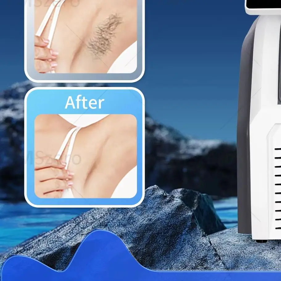 5000W Professional Soprano 808 Laser Hair Removal Device Diode Laser Hair Removal Machine 3 Wavelengths with Cooling Handle
5000W Professional Soprano 808 Laser Hair Removal Device Diode Laser Hair Removal Machine 3 Wavelengths with Cooling Handle