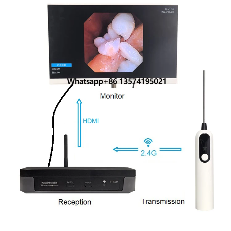 Private Label Low Price Wireless Endoscope Medical Endoscope Video Digital Otoscope Set
Private Label Low Price Wireless Endoscope Medical Endoscope Video Digital Otoscope Set