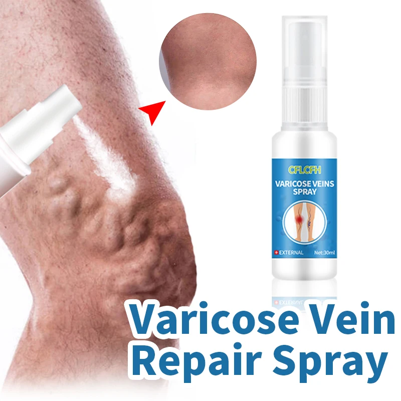 Varicose Veins Spray Foot Care Medicine Vasculitis Phlebitis Spider Leg Treatment Angiitis Legs Dilated Varicosity Relief Liquid
Varicose Veins Spray Foot Care Medicine Vasculitis Phlebitis Spider Leg Treatment Angiitis Legs Dilated Varicosity Relief Liquid
