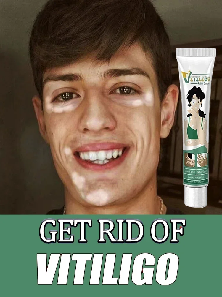 Remove White Spot Cream for Vitiligo White Spots Leukoplakia Pigmentation Melanin Promoting Vitiligo Cream Skin Care
Remove White Spot Cream for Vitiligo White Spots Leukoplakia Pigmentation Melanin Promoting Vitiligo Cream Skin Care
