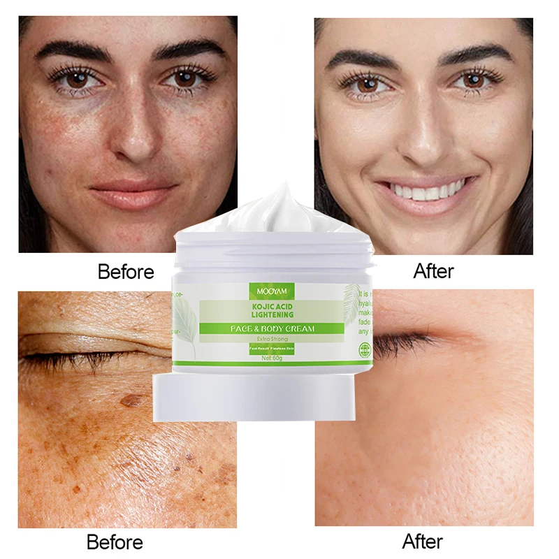 Kojic Acid Face Cream Hydrating Moisturizer Brightening Skin Tone Anti-Aging Facial Body Beauty Improve dryness Skincare
Kojic Acid Face Cream Hydrating Moisturizer Brightening Skin Tone Anti-Aging Facial Body Beauty Improve dryness Skincare