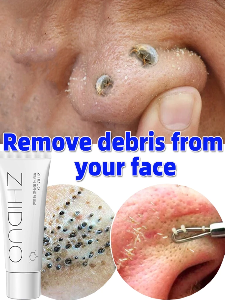 Deep Cleansing Acne Cleanser Professional Blackhead Removal Facial Wash Long-lasting Oil Control & Skin Whitening
Deep Cleansing Acne Cleanser Professional Blackhead Removal Facial Wash Long-lasting Oil Control & Skin Whitening