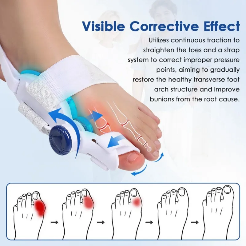【NEW PRODUCTS TO BE RELEASED IN 2026 】Bunion Corrector Adjustable Big Toe Straightener For Hallux Valgus Pain Relief For Women&
【NEW PRODUCTS TO BE RELEASED IN 2026 】Bunion Corrector Adjustable Big Toe Straightener For Hallux Valgus Pain Relief For Women&