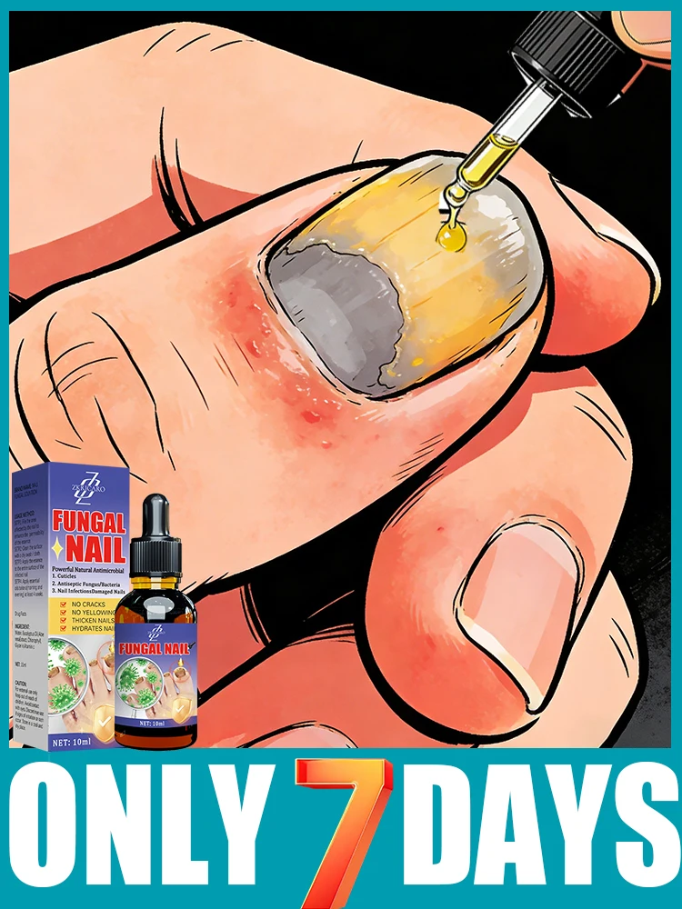 Natural Nail Care Essential Oil Nourishes & Revitalizes Toenails Fingernails
Natural Nail Care Essential Oil Nourishes & Revitalizes Toenails Fingernails