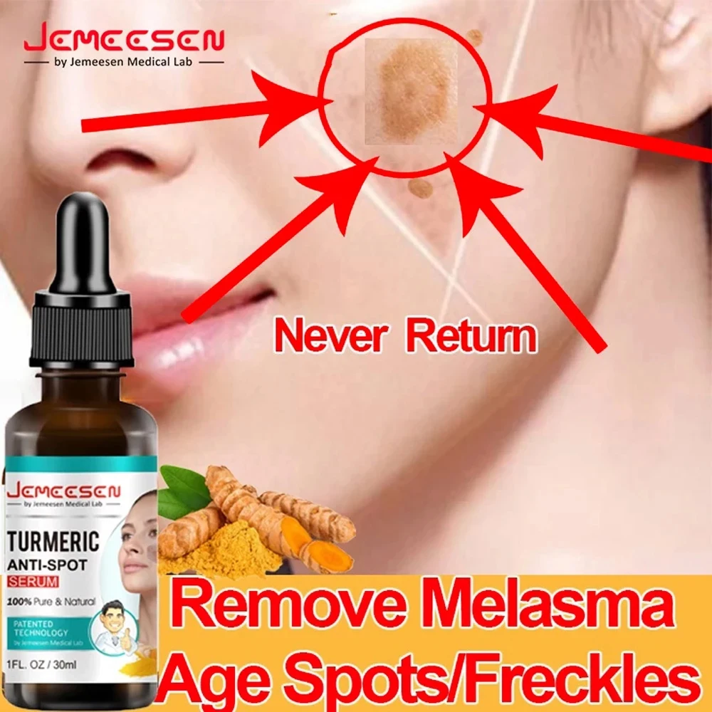Jemeesen age sports pigment turmeric anti-freckle whitening essence anti-freckle removal chloasma/calm anti-aging moisturizing
Jemeesen age sports pigment turmeric anti-freckle whitening essence anti-freckle removal chloasma/calm anti-aging moisturizing