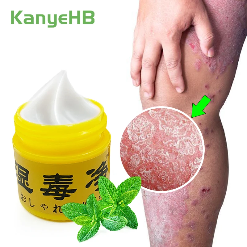 1pcs Mint Psoriasis Cream Tinea Pedis Cream Jock Itch Skin Fungal Infection Treatment Ointment Anti-itch Anti-inflammatory S054
1pcs Mint Psoriasis Cream Tinea Pedis Cream Jock Itch Skin Fungal Infection Treatment Ointment Anti-itch Anti-inflammatory S054