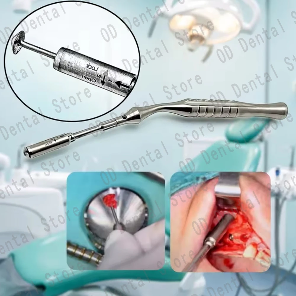 Stainless Steel Dental Bone Collector & Scraper Set – For Implant Site Prep and Calculus Removal
Stainless Steel Dental Bone Collector & Scraper Set – For Implant Site Prep and Calculus Removal