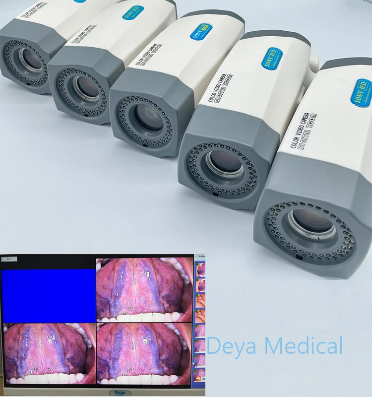 LED Video Display Electronic Colposcope for Gynecology
LED Video Display Electronic Colposcope for Gynecology