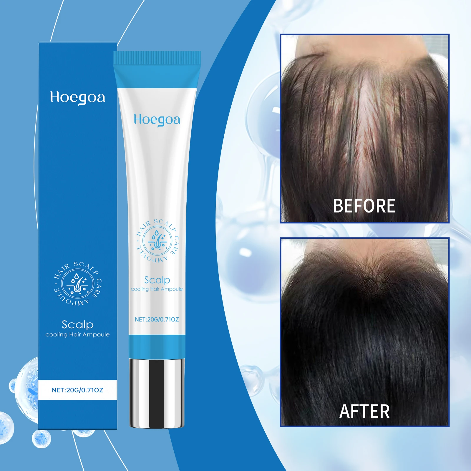 Эфирное масло для ухода за волосами с имбирем, гладкий блеск, сыворотка для волос против вьющихся волос, способствует укреплению роста волос, питательное лечение кожи головы
Эфирное масло для ухода за волосами с имбирем, гладкий блеск, сыворотка для волос против вьющихся волос, способствует укреплению роста волос, питательное лечение кожи головы