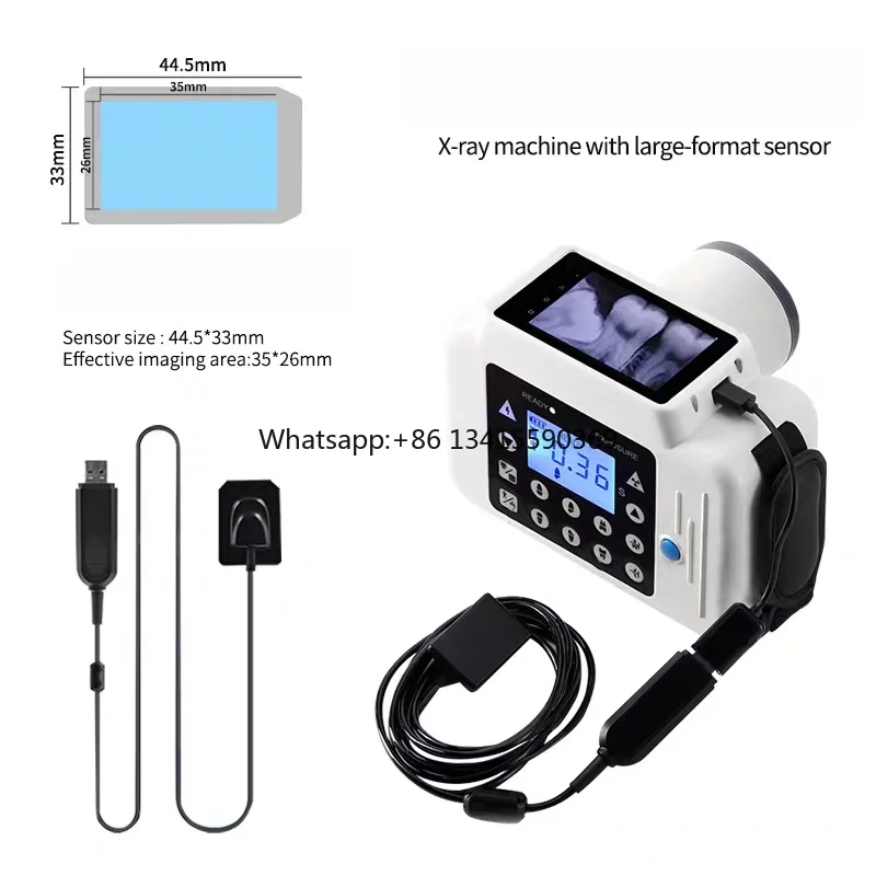 Sensor Digital De Rayos X Rayos X Dental Portatil Y Sensor
Sensor Digital De Rayos X Rayos X Dental Portatil Y Sensor