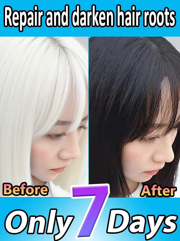 White to Black Hair Serum Gʀᴀʏ Hᴀɪʀ Tʀᴇᴀᴛᴍᴇɴᴛ Nᴀᴛᴜʀᴀʟ Cᴏʟᴏʀ Rᴇᴘᴀɪʀ Nᴏᴜʀɪsʜɪɴɢ Aɴᴛɪ-Hᴀɪʀ Lᴏss Cᴀʀᴇ Mᴇɴ Wᴏᴍᴇɴ
White to Black Hair Serum Gʀᴀʏ Hᴀɪʀ Tʀᴇᴀᴛᴍᴇɴᴛ Nᴀᴛᴜʀᴀʟ Cᴏʟᴏʀ Rᴇᴘᴀɪʀ Nᴏᴜʀɪsʜɪɴɢ Aɴᴛɪ-Hᴀɪʀ Lᴏss Cᴀʀᴇ Mᴇɴ Wᴏᴍᴇɴ