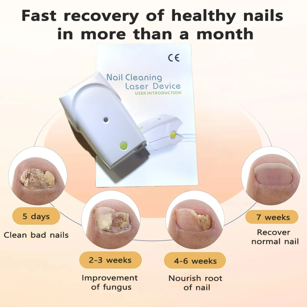 Portable 905nm Laser Nail Device USB Rechargeable for Nail Maintenance Supports Healthy Looking Nails
Portable 905nm Laser Nail Device USB Rechargeable for Nail Maintenance Supports Healthy Looking Nails
