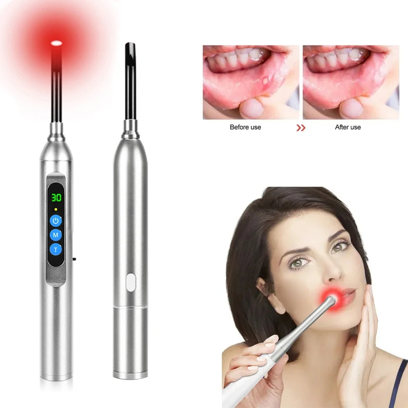 Cold Sore Laser Therapy Device Physiotherapy Mouth Ulceration Blisters Herpes Infection Pain Relief Ulcer Medical Laser Care
Cold Sore Laser Therapy Device Physiotherapy Mouth Ulceration Blisters Herpes Infection Pain Relief Ulcer Medical Laser Care