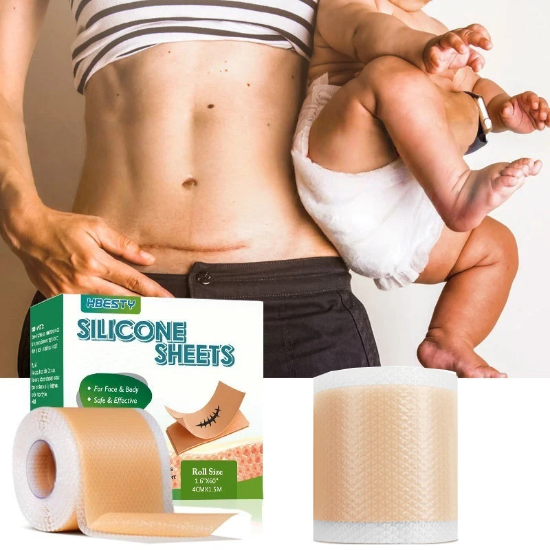 4*150 / 300 Cm Silicone Gel Scar Rolls Patches New Old Wounds Cesarean Section Scars Waterproof Self-Adhesive Patces
4*150 / 300 Cm Silicone Gel Scar Rolls Patches New Old Wounds Cesarean Section Scars Waterproof Self-Adhesive Patces
