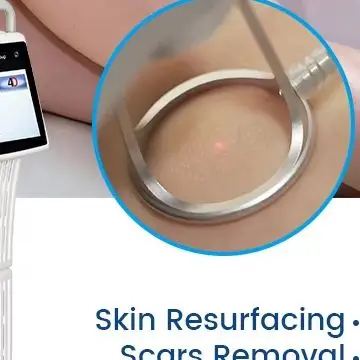 Fractional CO2 Lase Beauty Equipment Infrared Light Guide Dust CoolingTube for Syringoma Softening Complexion BrighteningMachine
Fractional CO2 Lase Beauty Equipment Infrared Light Guide Dust CoolingTube for Syringoma Softening Complexion BrighteningMachine