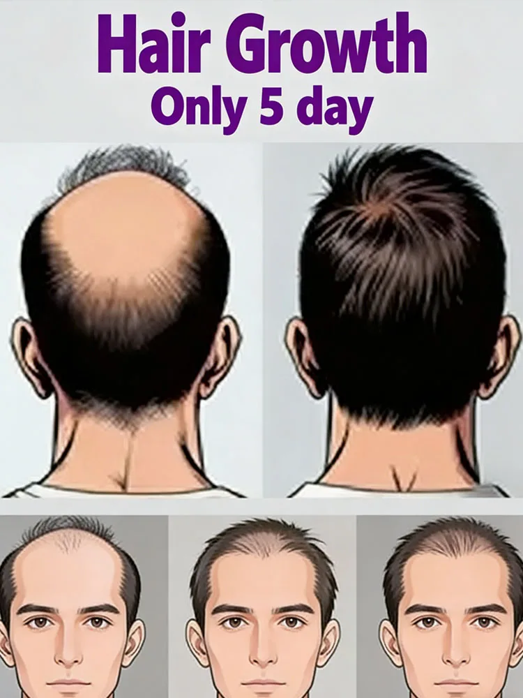 Поколение 2: Питает корни волос, создавая здоровые, шелковистые и объемные волосы.
Поколение 2: Питает корни волос, создавая здоровые, шелковистые и объемные волосы.