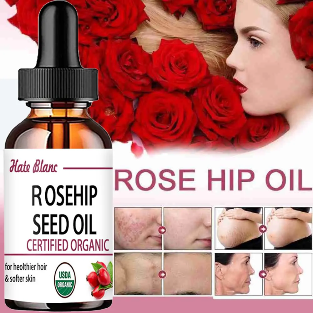 Pure Essential Oils Rosehip Oil Moisturizing Brighten Skin Color Essential Oil Anti-Dry Anti-Aging Face Essential
Pure Essential Oils Rosehip Oil Moisturizing Brighten Skin Color Essential Oil Anti-Dry Anti-Aging Face Essential